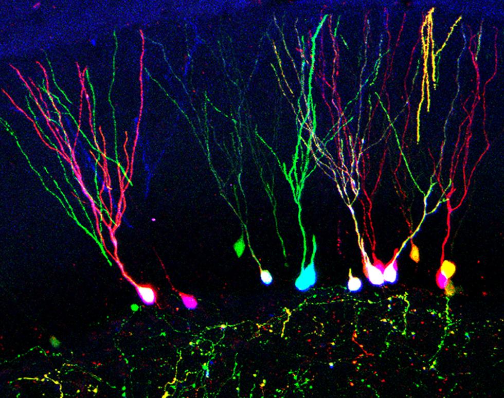 Multicolour Retroviral Tracing of Newborn Neurons - Diego Gomez-Nicola